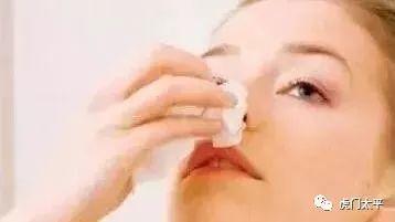 成人止鼻血棉球怎么用视频,成人操作指南-第2张图片-成年电影网